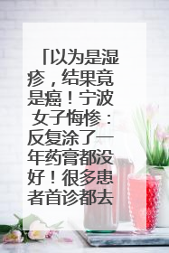 以为是湿疹，结果竟是癌！宁波女子悔惨：反复涂了一年药膏都没好！很多患者首诊都去了皮肤科
